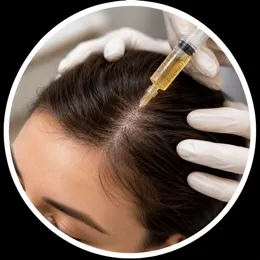 PRP Eigenbluttherapie gegen Haarausfall