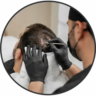 Schonende Entnahme der Haarfollikel (Grafts)