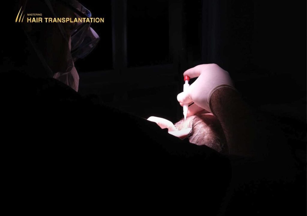 Moderne Haartransplantation Klinik in Hannover