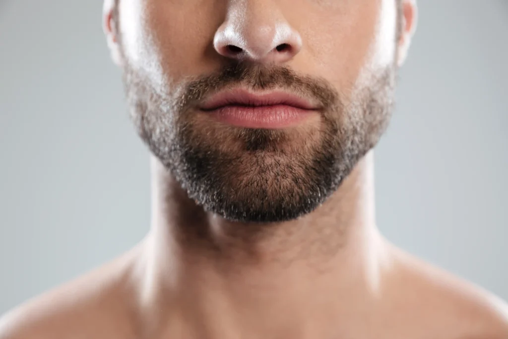 Moderne Haartransplantation Klinik in Hannover